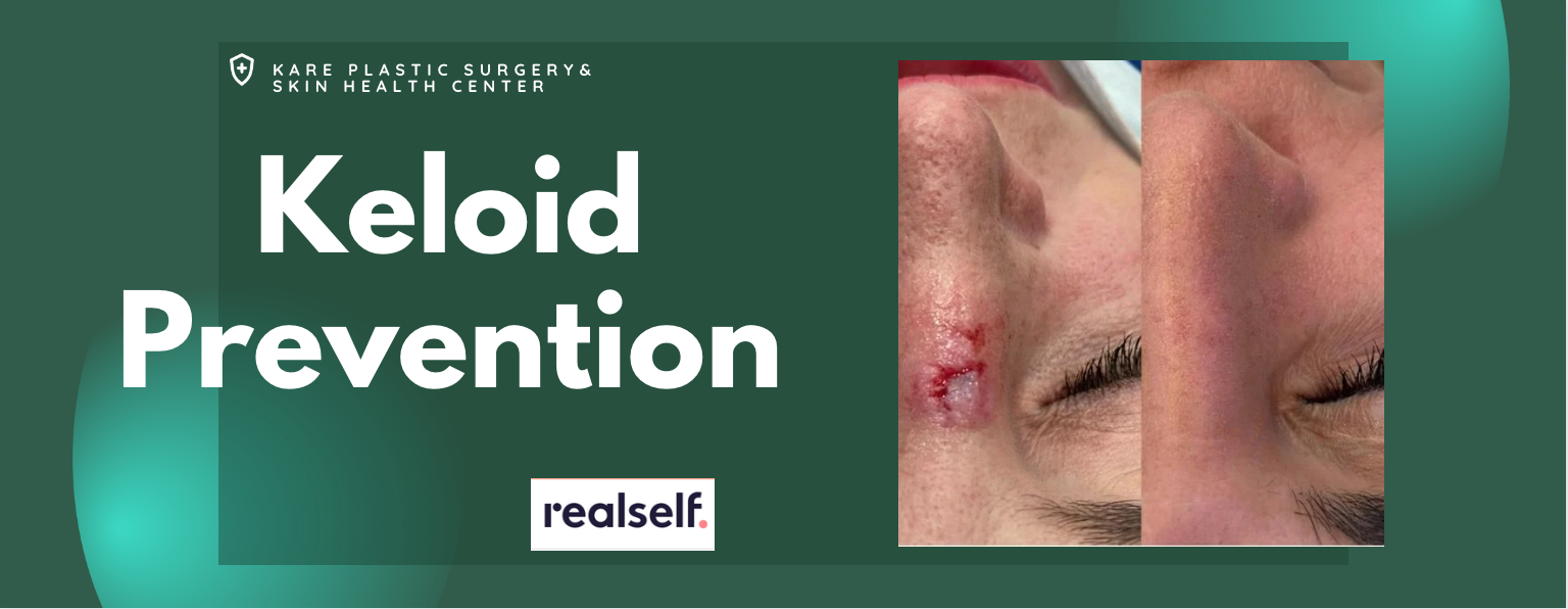 Emergency Laceration Repair in Los Angeles Stitch Doctor